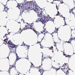 Bestrophin 4 Antibody, Novus Biologicals 25 &mu;L | Buy Online | Novus Biologicals | Fisher Scientific