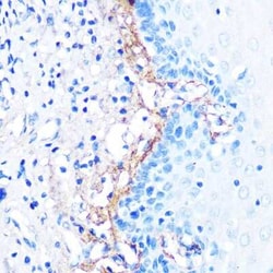 Beta Ig-h3/TGFBI Rabbit anti-Human, Mouse, Rat, Clone: 7Q5O9, Novus Biologicals