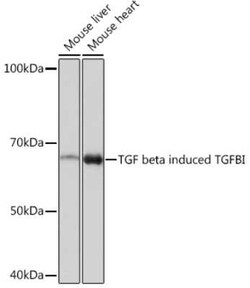 Beta Ig-h3/TGFBI Rabbit anti-Human, Mouse, Rat, Clone: 7Q5O9, Novus Biologicals