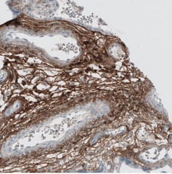 Beta Ig-h3/TGFBI Antibody, Novus Biologicals:Antibodies:Primary Antibodies