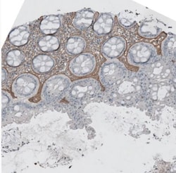 Beta Ig-h3/TGFBI Antibody, Novus Biologicals:Antibodies:Primary Antibodies