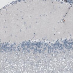 Beta Ig-h3/TGFBI Antibody, Novus Biologicals:Antibodies:Primary Antibodies