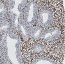 Beta Ig-h3/TGFBI Antibody, Novus Biologicals:Antibodies:Primary Antibodies