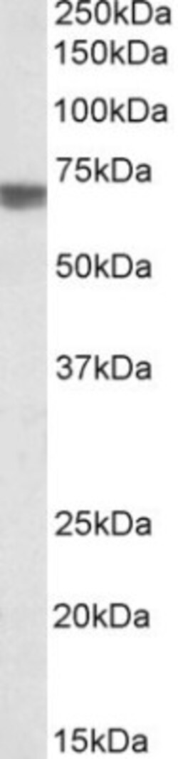 Beta Ig-h3/TGFBI Antibody, Novus Biologicals 0.1mg; Unlabeled:Antibodies,