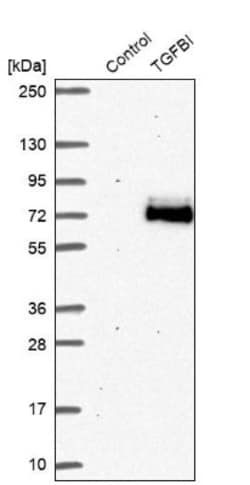 Beta Ig-h3/TGFBI Antibody, Novus Biologicals:Antibodies:Primary Antibodies