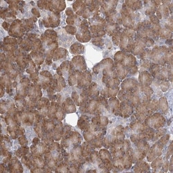 LACTB Antibody, Novus Biologicals 25 &mu;L; Unlabeled:Antibodies, Polyclonal