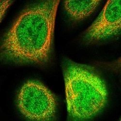 Biliverdin Reductase B/BLVRB Antibody, Novus Biologicals:Antibodies:Primary
