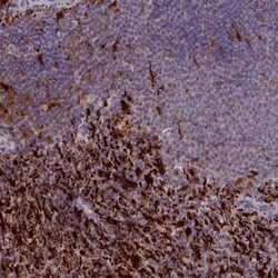 Biliverdin Reductase B/BLVRB Antibody, Novus Biologicals:Antibodies:Primary