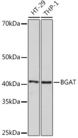 Blood Group B Transferase/GTB/ABO Rabbit anti-Human, Mouse, Clone: 2V4R0,