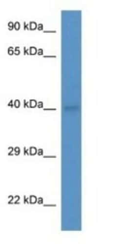 Blood Group B Transferase/GTB/ABO Antibody, Novus Biologicals 100&mu;L;