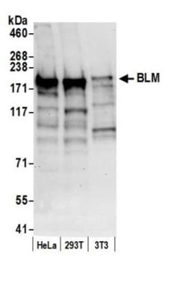 Blooms Syndrome Protein Blm Antibody, Novus Biologicals 0.1mL; Unlabeled:Antibodies,