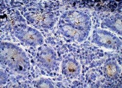 BoNT-A Light Chain Antibody, Novus Biologicals 100 &mu;g | Buy Online | Novus Biologicals | Fisher Scientific