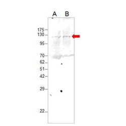 BoNT-A Light Chain Antibody, Novus Biologicals 100 &mu;g | Buy Online | Novus Biologicals | Fisher Scientific