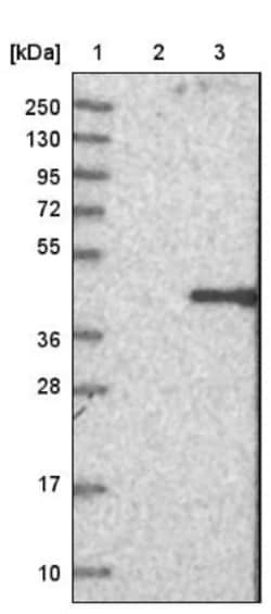 Boll Antibody, Novus Biologicals:Antibodies:Primary Antibodies