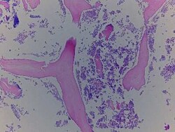 Novus Biologicals Bone Marrow Tissue Slides (Diabetes)- Paraffin 5 Slides | Buy Online | Novus Biologicals&trade; | Fisher Scientific