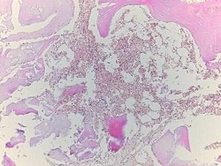 Novus Biologicals Bone Tissue Slides (Chondroma)- Paraffin 5 Slides | Buy Online | Novus Biologicals&trade; | Fisher Scientific