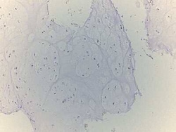 Novus Biologicals Bone Tissue Slides (Chondrosarcoma Grade I-II)- Paraffin 5 Objektträger | Buy Online | Novus Biologicals&trade; | Fisher Scientific