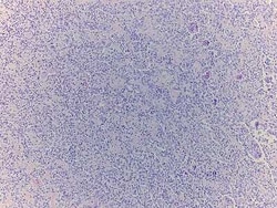 Novus Biologicals Bone Tissue Slides (Giant Cell Tumor Grade I-II)- Paraffin 5 Slides | Buy Online | Novus Biologicals&trade; | Fisher Scientific