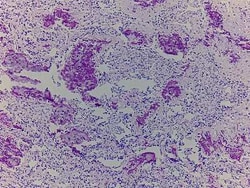 Novus Biologicals Bone Tissue Slides (Tumor)- Paraffin 5 Slides | Buy Online | Novus Biologicals&trade; | Fisher Scientific