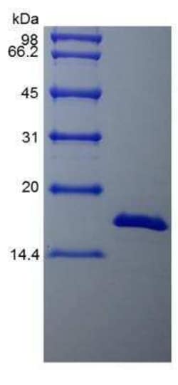 Novus Biologicals Recombinant Bovine FGF basic/FGF2/bFGF Protein 10 &mu;g | Buy Online | Novus Biologicals&trade; | Fisher Scientific