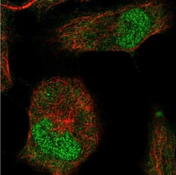 Brachyury Antibody, Novus Biologicals 25 &mu;L; Unlabeled:Antibodies, Polyclonal