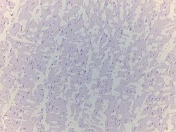 Novus Biologicals&trade;&nbsp;Brain Amygdala Tissue Slides (Multiple Sclerosis)- Paraffin