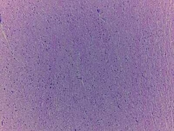 Novus Biologicals Brain Basal Ganglia Tissue Slides (Adult Normal)- Paraffin 5 Slides | Buy Online | Novus Biologicals&trade; | Fisher Scientific