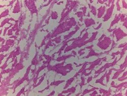 Novus Biologicals Brain Cerebellum Tissue Slides (Adult Normal Left)- Frozen 5 Slides | Buy Online | Novus Biologicals&trade; | Fisher Scientific