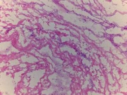 Novus Biologicals&trade;&nbsp;Brain Cerebral Meninges Tissue Slides (Adult Normal)- Frozen