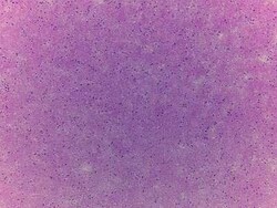 Novus Biologicals Brain Corpus Callosum Tissue Slides (Adult Normal)- Frozen 5 Slides | Buy Online | Novus Biologicals&trade; | Fisher Scientific