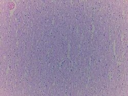 Novus Biologicals Brain Corpus Callosum Tissue Slides (Adult Normal)- Paraffin 5 portaobjetos | Buy Online | Novus Biologicals&trade; | Fisher Scientific