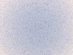 Novus Biologicals Brain Corpus Callosum Tissue Slides (Multiple Sclerosis)- Paraffin 5 Slides | Buy Online | Novus Biologicals&trade; | Fisher Scientific