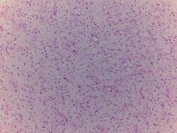 Novus Biologicals Brain Frontal Lobe Tissue Slides (Adult Normal)- Frozen 5 Slides | Buy Online | Novus Biologicals&trade; | Fisher Scientific