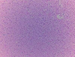 Novus Biologicals&trade;&nbsp;Brain Frontal Lobe Tissue Slides (Adult Normal)- Paraffin