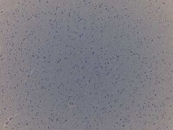 Novus Biologicals Brain Frontal Lobe Tissue Slides (Alzheimer's)- Paraffin 5 Slides | Buy Online | Novus Biologicals&trade; | Fisher Scientific