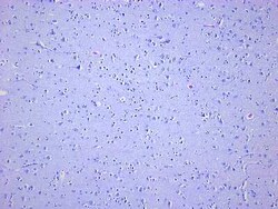 Novus Biologicals Brain Frontal Lobe Tissue Slides (Parkinson's)- Paraffin 5 portaobjetos | Buy Online | Novus Biologicals&trade; | Fisher Scientific