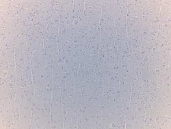 Novus Biologicals Brain Hippocampus Tissue Slides (Alzheimer's)- Paraffin 5 Slides | Buy Online | Novus Biologicals&trade; | Fisher Scientific