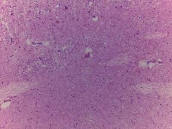 Novus Biologicals Brain Medulla Oblongata Tissue Slides (Adult Normal)- Frozen 5 lames | Buy Online | Novus Biologicals&trade; | Fisher Scientific