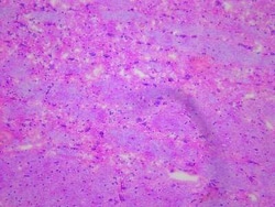 Novus Biologicals Brain Medulla Oblongata Tissue Slides (Parkinson's)- Frozen 5 Slides | Buy Online | Novus Biologicals&trade; | Fisher Scientific