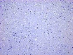 Novus Biologicals Brain Medulla Oblongata Tissue Slides (Parkinson's)- Paraffin 5 Slides | Buy Online | Novus Biologicals&trade; | Fisher Scientific