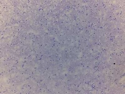 Novus Biologicals Brain Parietal Lobe Tissue Slides (Adult Normal)- Frozen 5 Slides | Buy Online | Novus Biologicals&trade; | Fisher Scientific
