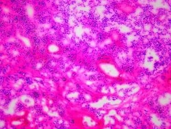 Novus Biologicals&trade;&nbsp;Brain Pituitary Tissue Slides (Multiple Sclerosis)- Frozen