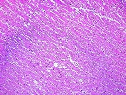 Novus Biologicals Brain Pons Tissue Slides (Multiple Sclerosis)- Paraffin 5 Slides | Buy Online | Novus Biologicals&trade; | Fisher Scientific