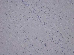 Novus Biologicals Brain Pons Tissue Slides (Parkinson's)- Paraffin 5 Slides | Buy Online | Novus Biologicals&trade; | Fisher Scientific