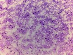 Novus Biologicals&trade;&nbsp;Brain Postcentral Gyrus Tissue Slides (Multiple Sclerosis)- Frozen