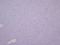 Novus Biologicals Brain Postcentral Gyrus Tissue Slides (Multiple Sclerosis)- Paraffin 5 Slides | Buy Online | Novus Biologicals&trade; | Fisher Scientific