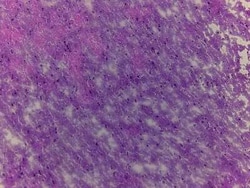 Novus Biologicals Brain Precentral Gyrus Tissue Slides (Adult Normal)- Frozen 5 Slides | Buy Online | Novus Biologicals&trade; | Fisher Scientific