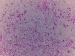 Novus Biologicals Brain Temporal Lobe Tissue Slides (Adult Normal)- Frozen 5 Slides | Buy Online | Novus Biologicals&trade; | Fisher Scientific