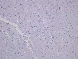 Novus Biologicals Brain Temporal Lobe Tissue Slides (Dementia)- Paraffin 5 Slides | Buy Online | Novus Biologicals&trade; | Fisher Scientific