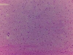 R&D Systems&trade;&nbsp;Brain Temporal Lobe Tissue Slides (Multiple Sclerosis)- Frozen